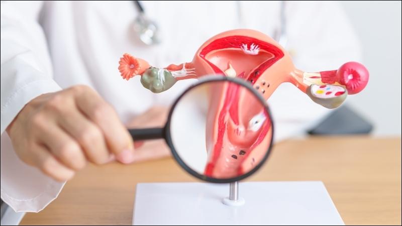 Misoprostol có thể dùng để làm chín cổ tử cung trước khi thực hiện các thủ thuật khác Misoprostol có thể dùng để làm chín cổ tử cung trước khi thực hiện các thủ thuật khác