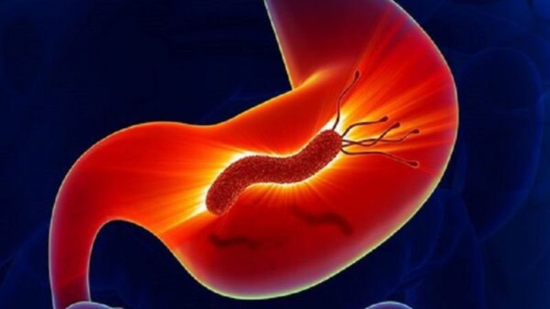 Nụ vối còn giúp đẩy lùi tình trạng loét dạ dày do vi khuẩn H. pylori gây ra