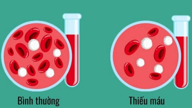 Tam thất ngâm mật ong giúp cải thiện tình trạng thiếu máu