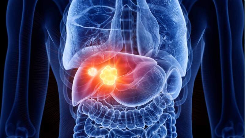 Chiết xuất nước của cỏ tranh và polysaccharides ức chế sự tăng sinh của dòng tế bào ung thư gan ở người