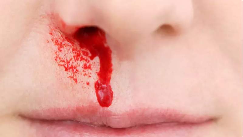Lấy rễ cỏ tranh tươi sắc lấy nước uống hàng ngày sau khi ăn giúp trị chảy máu cam