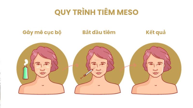 Một liệu trình tiêm thường kéo dài từ 3 - 15 lần sẽ mang lại hiệu quả