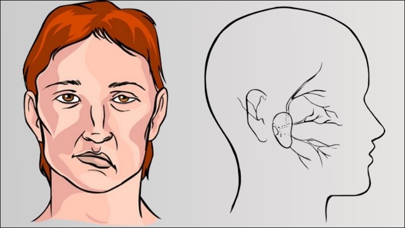 Giã lá xương sông và lá xương bồ rồi chắt lấy nước uống để chữa trúng phong