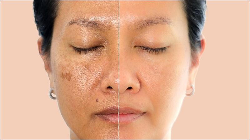 Glycerin có khả năng hỗ trợ làm chậm lão hóa da