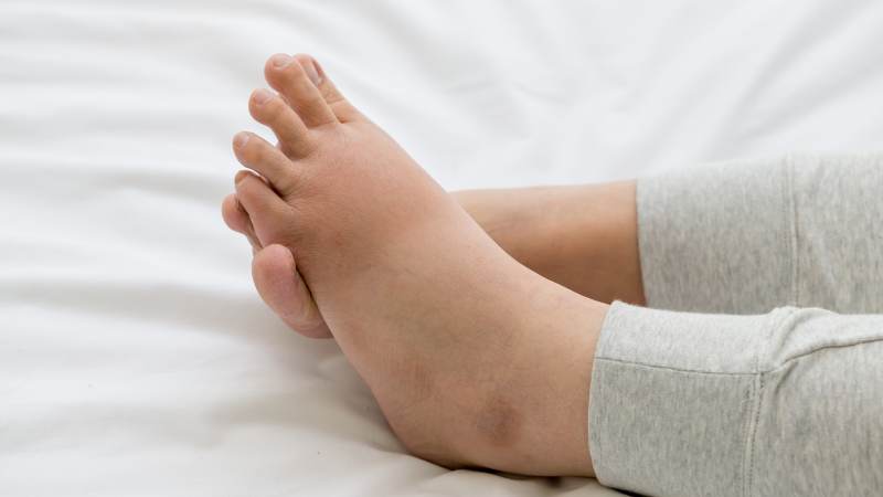 Mức độ phù nề chân ở phụ nữ mang thai được cải thiện sau khi ngâm với nước ấm và gừng