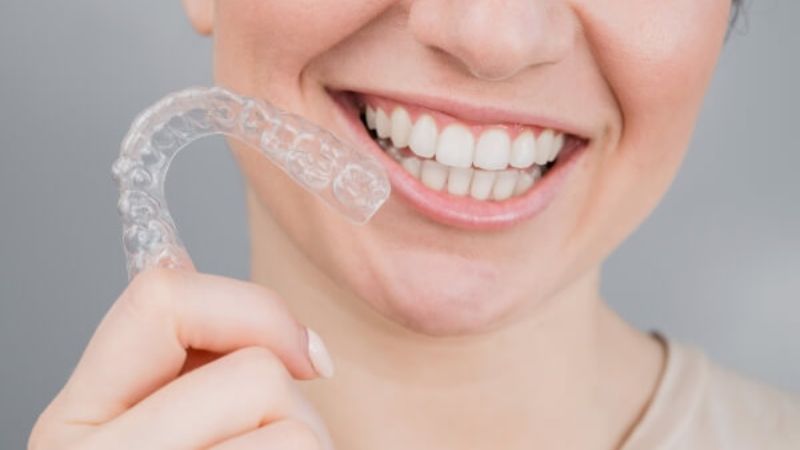 Niềng răng tạo nên một tỷ lệ khuôn mặt đẹp
