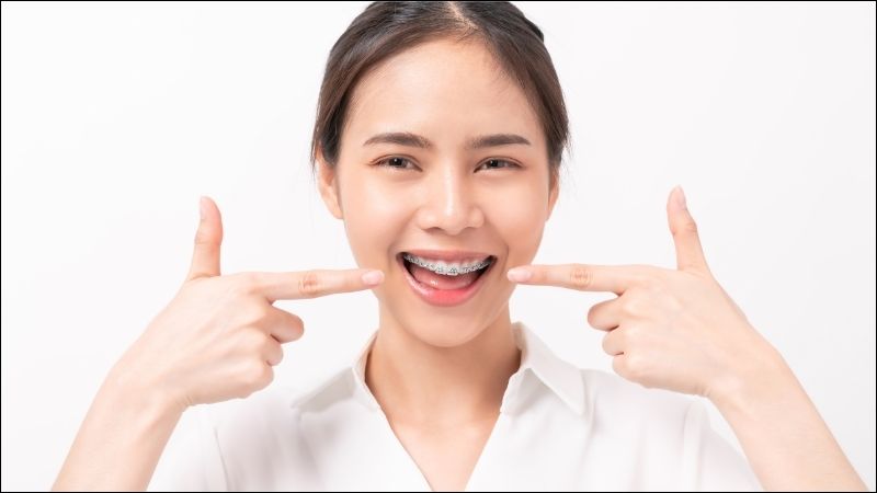 Niềng răng giúp giảm bớt cảm giác tự ti về vẻ bề ngoài của bản thân
