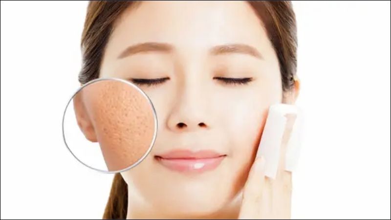 Đắp mặt nạ là một cách hiệu quả để làm se khít lỗ chân lông
