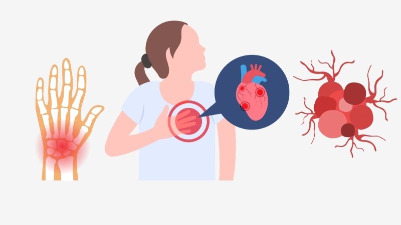 Các hoạt chất trong hành lá thể hiện hoạt tính chống viêm nhờ giảm stress oxy hóa