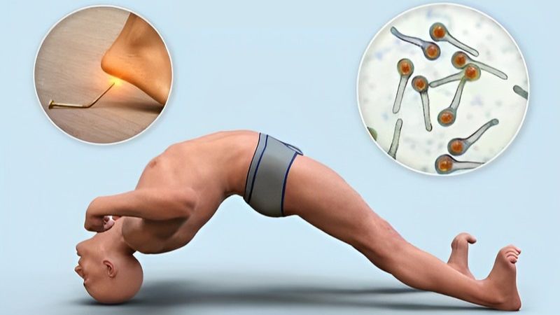 Chu sa khi kết hợp cùng với các dược liệu khác giúp điều trị bệnh uốn ván hiệu quả Chu sa khi kết hợp cùng với các dược liệu khác giúp điều trị bệnh uốn ván hiệu quả