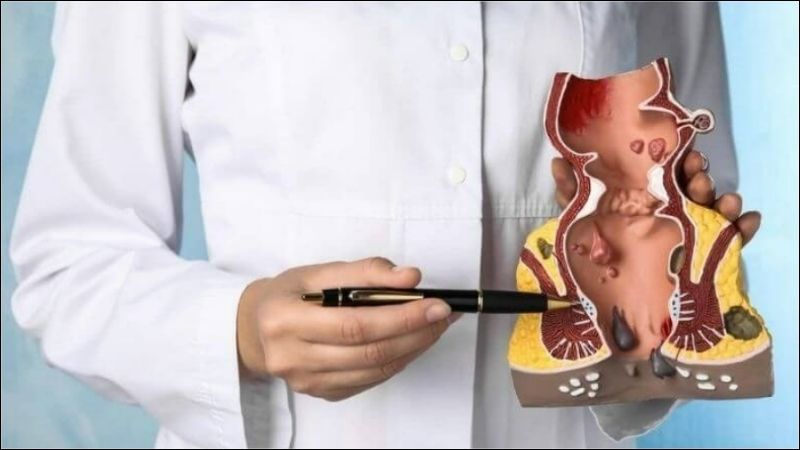 Trong y học cổ truyền, lá của cây cúc tần được sử dụng rộng rãi để điều trị bệnh trĩ