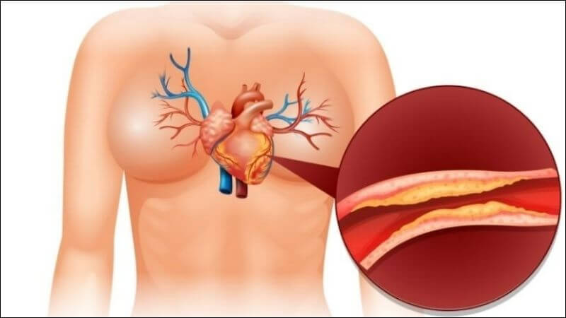 Chà là có khả năng giảm đáng kể các chỉ số mỡ máu như triglycerides, cholesterol toàn phần (T-C) và LDL-C (cholesterol xấu) qua đó giúp bảo vệ hệ tim mạch