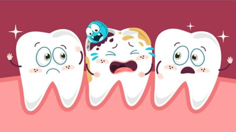 Chuối xanh chứa nhiều tinh bột - loại carbohydrate có khả năng bám dính lâu trên bề mặt răng hơn so với các loại đường thông thường