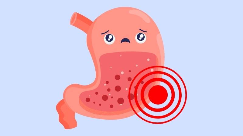Tính axit của nước chanh có thể gây kích ứng niêm mạc dạ dày và thực quản