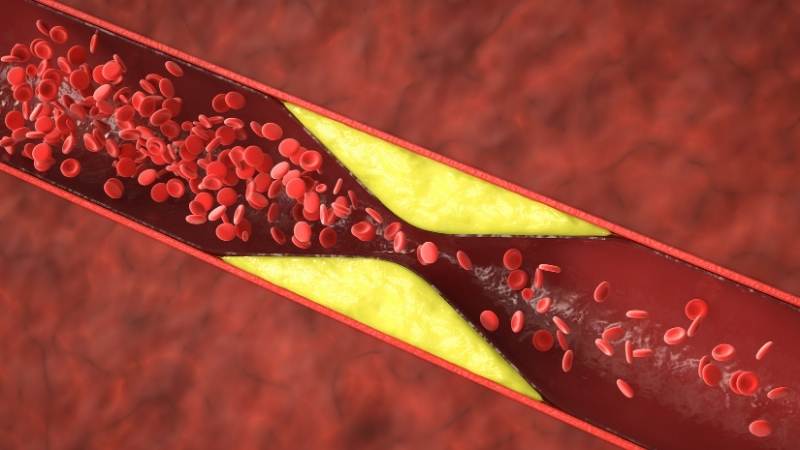 Khoai mỡ có khả năng hỗ trợ giảm mỡ máu và kiểm soát cholesterol