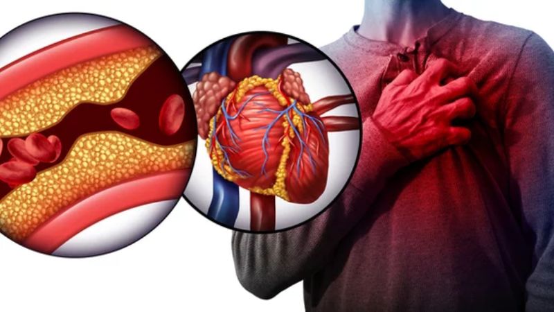 Hạt kê chứa nhiều hoạt chất giúp giảm nguy cơ xơ vữa động mạch hay đột quỵ Hạt kê chứa nhiều hoạt chất giúp giảm nguy cơ xơ vữa động mạch hay đột quỵ