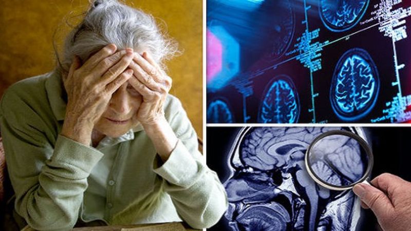 Polyphenol trong kê được chứng minh có tác dụng bảo vệ sức khỏe thần kinh trong bệnh Parkinson Polyphenol trong kê được chứng minh có tác dụng bảo vệ sức khỏe thần kinh trong bệnh Parkinson