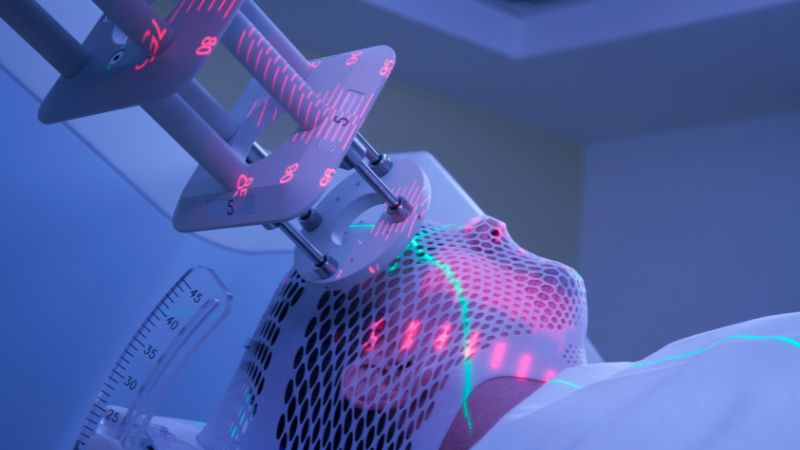 Hạt lanh hỗ trợ giảm biến chứng sau xạ trị