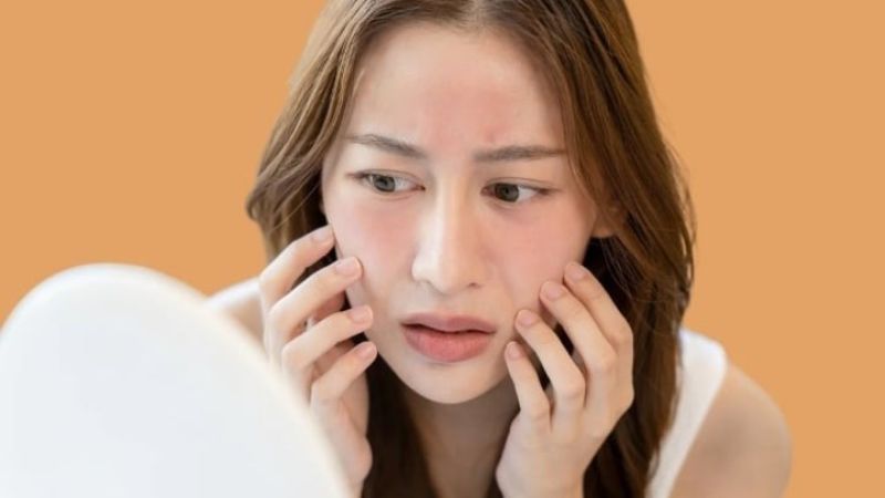 Cảm giác nóng rát, châm chích là tác dụng phụ thường gặp khi sử dụng acid azelaic