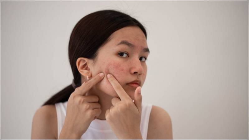 Mặt nạ đất sét có khả năng ngăn ngừa mụn hiệu quả Mặt nạ đất sét có khả năng ngăn ngừa mụn hiệu quả