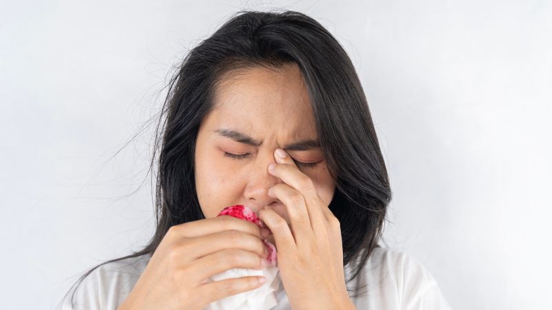 Isotretinoin gây ra các triệu chứng khô mũi, chảy máu cam