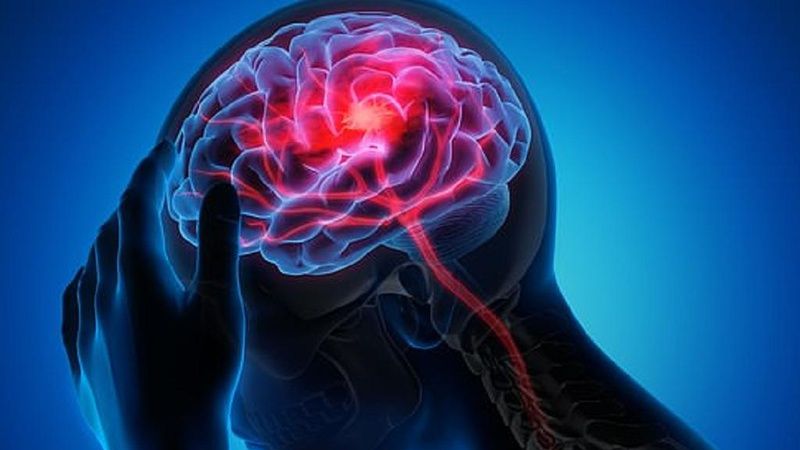 Isotretinoin gây ra áp lực nội sọ, đe dọa tính mạng