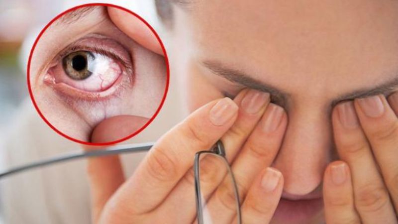 Sử dụng isotretinoin gây ra những thay đổi về thị lực và thính lực