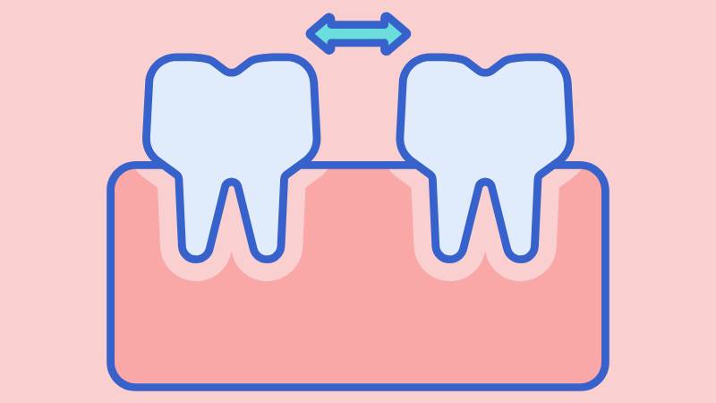 Sau khi lấy cao răng, bạn có thể cảm giác có khoảng trống giữa các răng