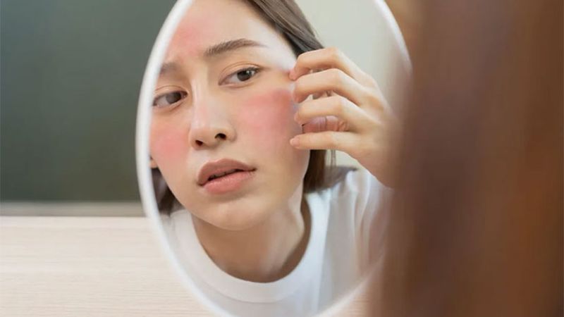 Tính axit tự nhiên của cà chua có thể gây phát ban đối với một số người