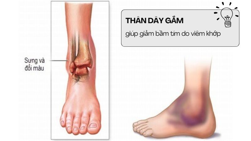 Th&acirc;n d&acirc;y gắm gi&uacute;p giảm bầm t&iacute;m do vi&ecirc;m khớp