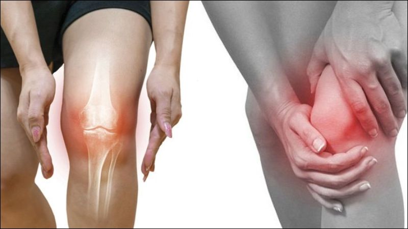 Viêm khớp là tình trạng hay gặp ở người lớn tuổi