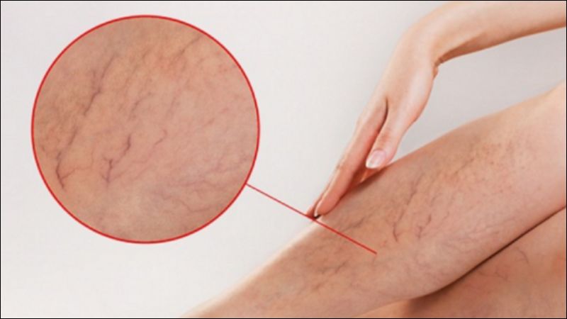 Tanshinone IIA trong đan sâm giúp tăng cường lưu thông máu