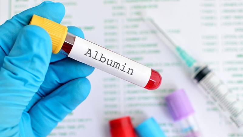 Albumin là protein chiếm một nửa tổng lượng protein trong huyết tương