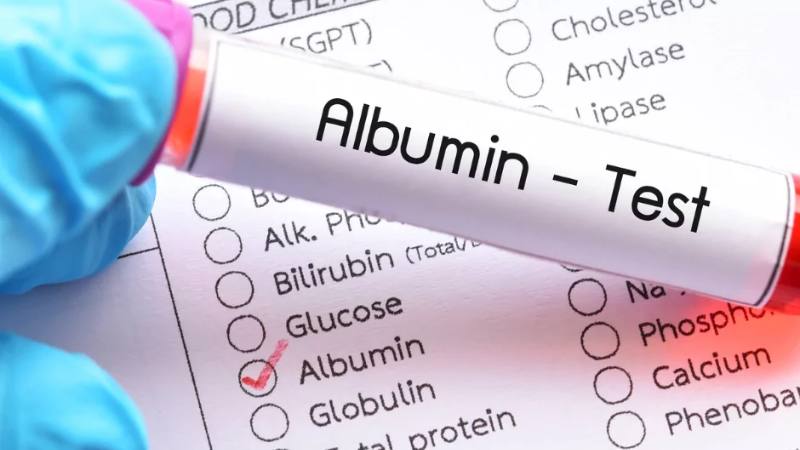 Albumin huyết thanh giúp đánh giá chức năng gan, tình trạng dinh dưỡng, một số bệnh lý của cơ thể,...