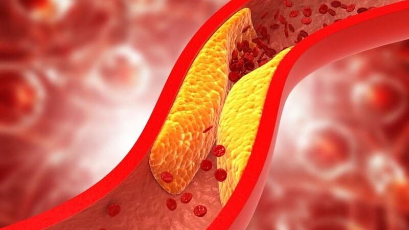 Chiết xuất từ bạch linh giúp giảm hình thành các mảng xơ vữa động mạch