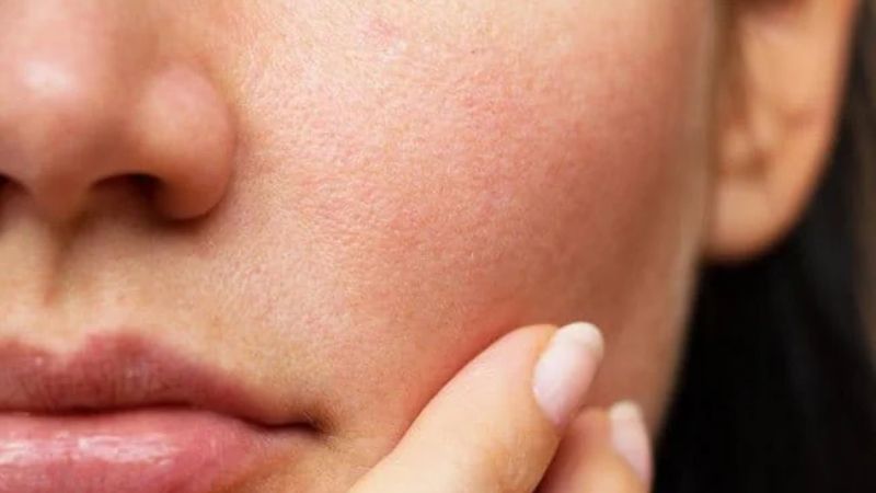 Bạch linh có hiệu quả trong việc làm giảm các tác động dẫn tới lão hóa da