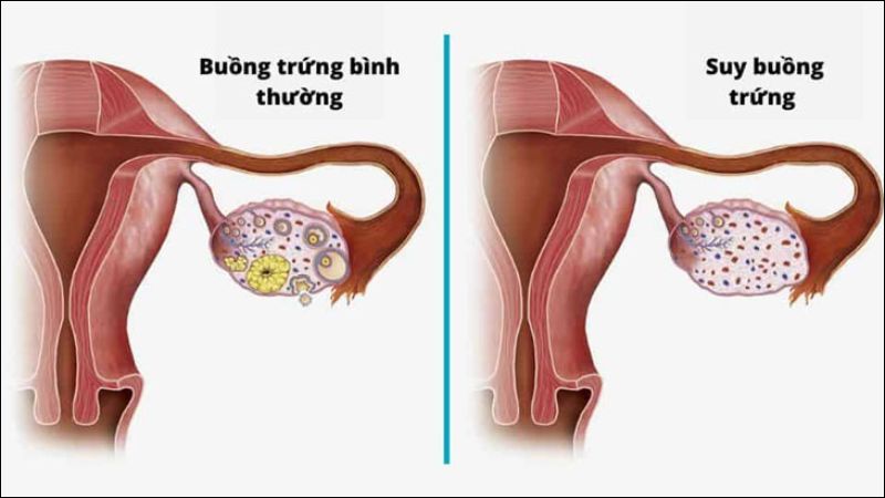Tiêu thụ đậu nành ở mức quá cao có thể làm suy giảm chức năng buồng trứng