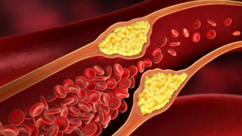 Kefir có thể giúp kiểm soát mỡ máu