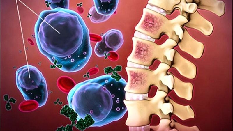 Sử dụng đông trùng hạ thảo có thể kích thích sự phát triển của tế bào ung thư tủy