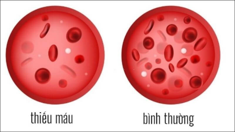Cứ 100g đường thốt nốt chứa khoảng 11mg sắt, tương đương 61% nhu cầu khuyến nghị hằng ngày
