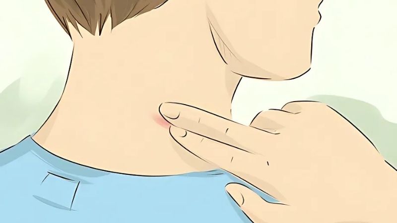 Massage quanh vết hickey có thể giúp tăng tuần hoàn máu và giảm đau