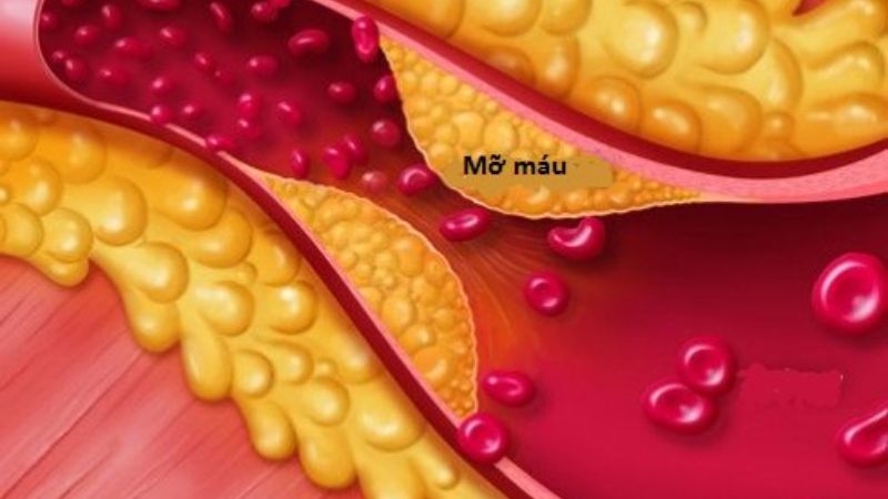 Chiết xuất từ cam thảo đất có thể làm giảm cholesterol toàn phần, LDL-cholesterol và làm tăng HDL-cholesterol (cholesterol tốt)