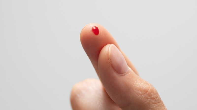 Thiếu máu tán huyết, giảm tiểu cầu là các tác dụng phụ hiếm gặp khi dùng diclofenac Thiếu máu tán huyết, giảm tiểu cầu là các tác dụng phụ hiếm gặp khi dùng diclofenac