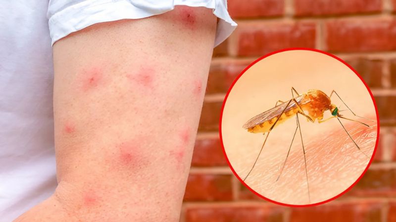 Hợp hoan bì giúp tiêu sưng do vết côn trùng cắn