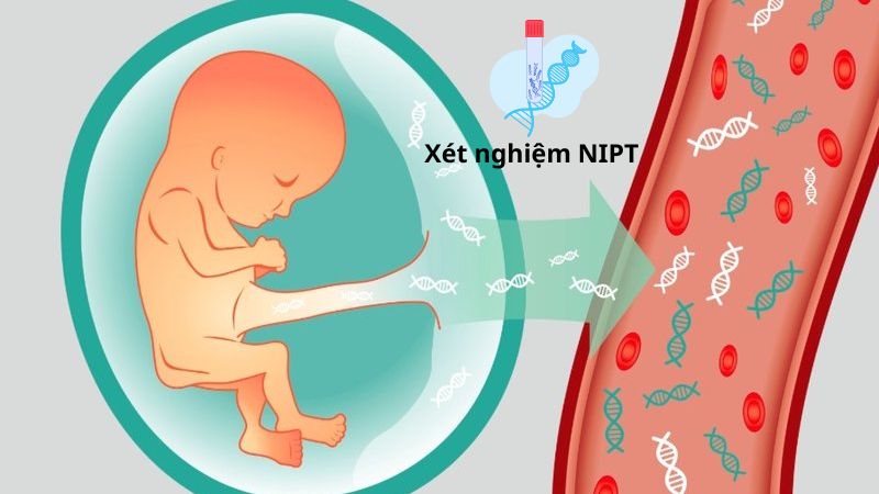 Xét nghiệm NIPT có chi phí dao động từ 2 đến 5 triệu đồng