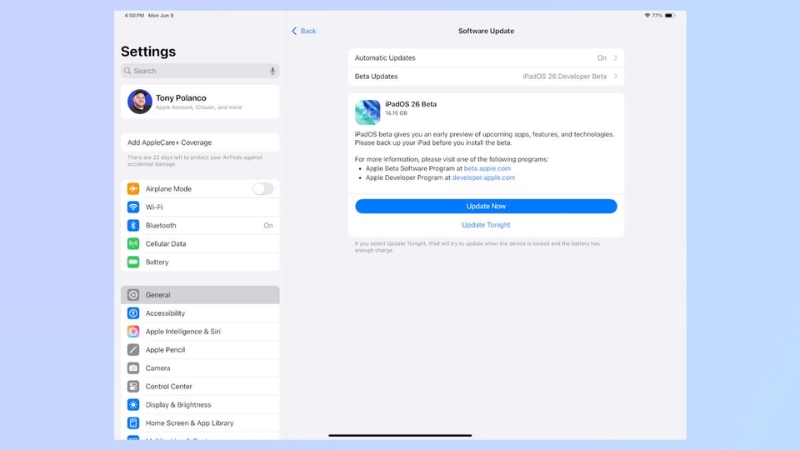 Chọn Cập nhật bây giờ để bắt đầu tải về Chọn Cập nhật bây giờ để bắt đầu tải về