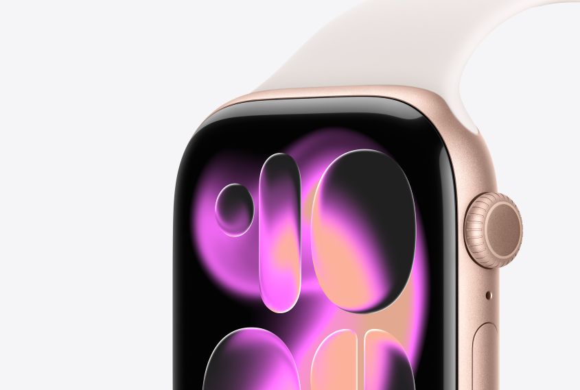  Apple Watch Series 11 m&agrave;u V&agrave;ng Hồng