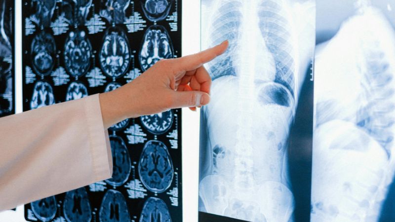 Bác sĩ sẽ chỉ định xét nghiệm chẩn đoán hình ảnh như chụp X-quang, siêu âm ổ bụng