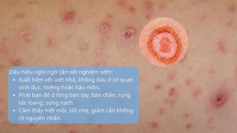 Các dấu hiệu nghi ngờ cần xét nghiệm giang mai