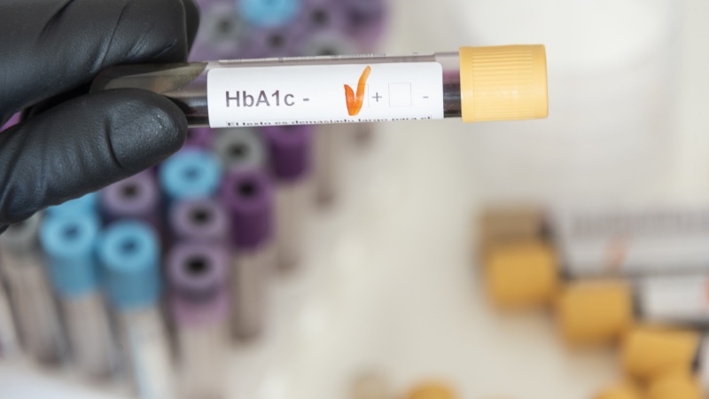 Ozempic được sử dụng để kiểm soát đường huyết và chỉ số HbA1c Ozempic được sử dụng để kiểm soát đường huyết và chỉ số HbA1c